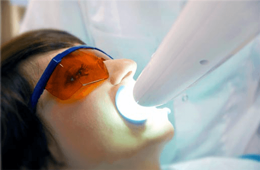 Understanding the Causes of Teeth Sensitivity Banbury