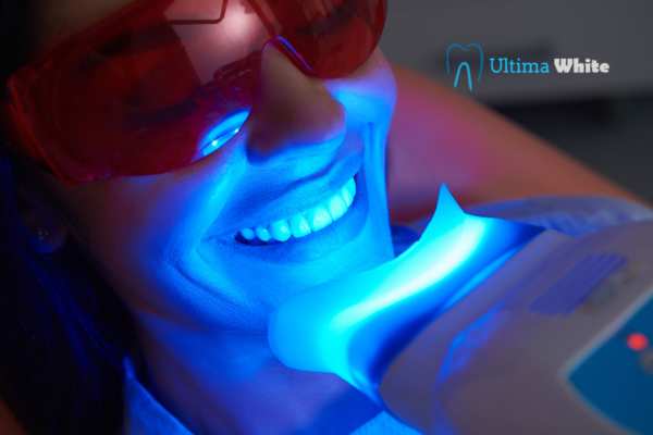 Which Teeth Whitening Technologies Are Leading the Way Banbury?