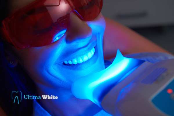 Professional Teeth Whitening Options Banbury