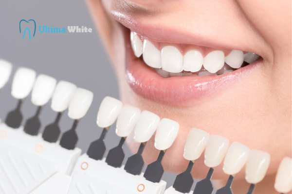 How to Maximise the Results of Your Laser Teeth Whitening Treatment Banbury