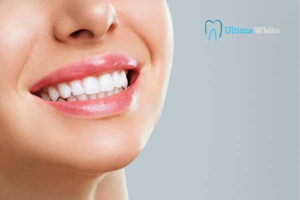 How Long Do Dental Crowns Last and How Can You Maintain Them Banbury?