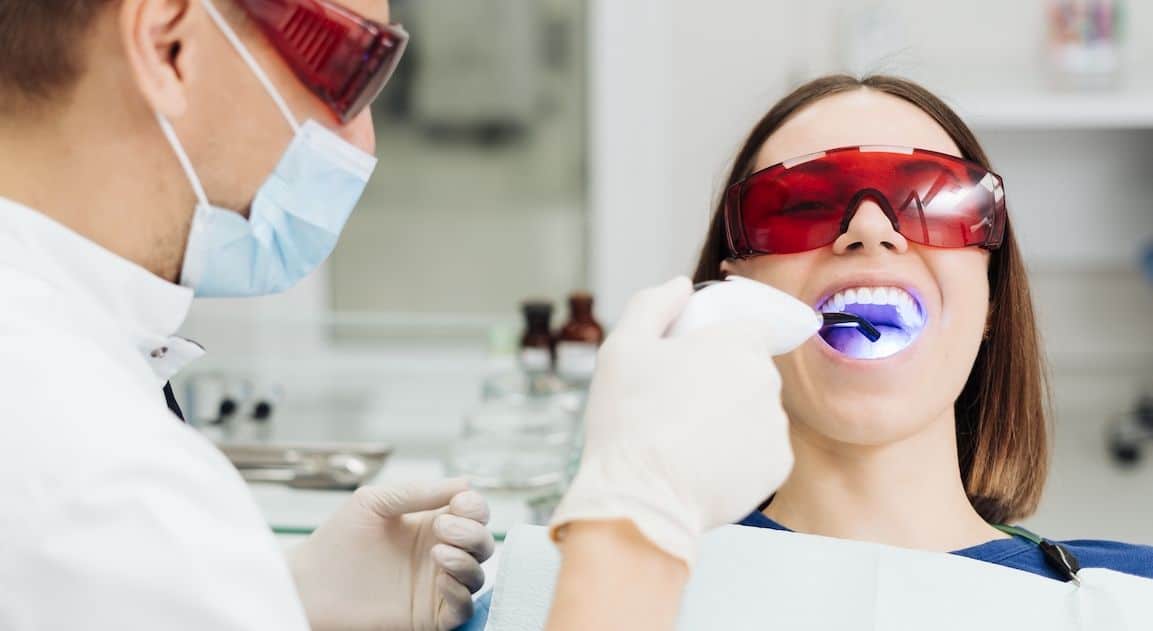 Do Dental Crowns Change Colour After Teeth Whitening Banbury?