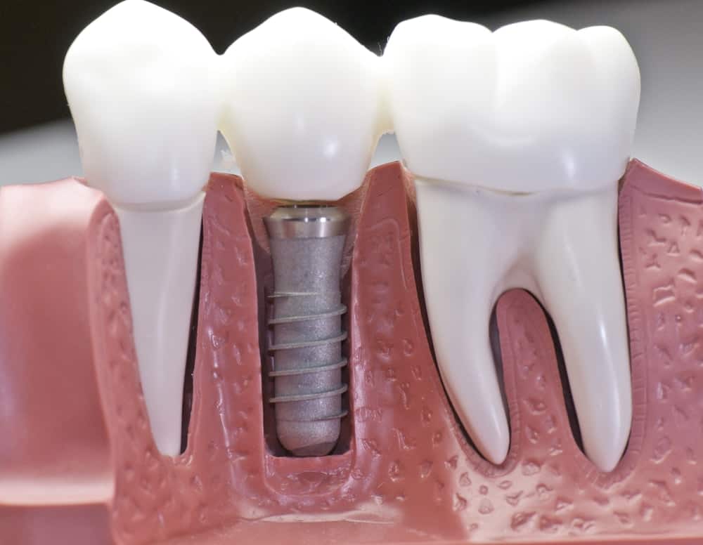 Common Misconceptions About Modern Dental Treatments Banbury