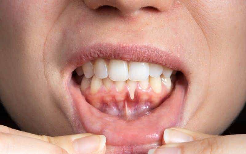 Final Thoughts: Building Lifelong Enamel Protection Habits Banbury