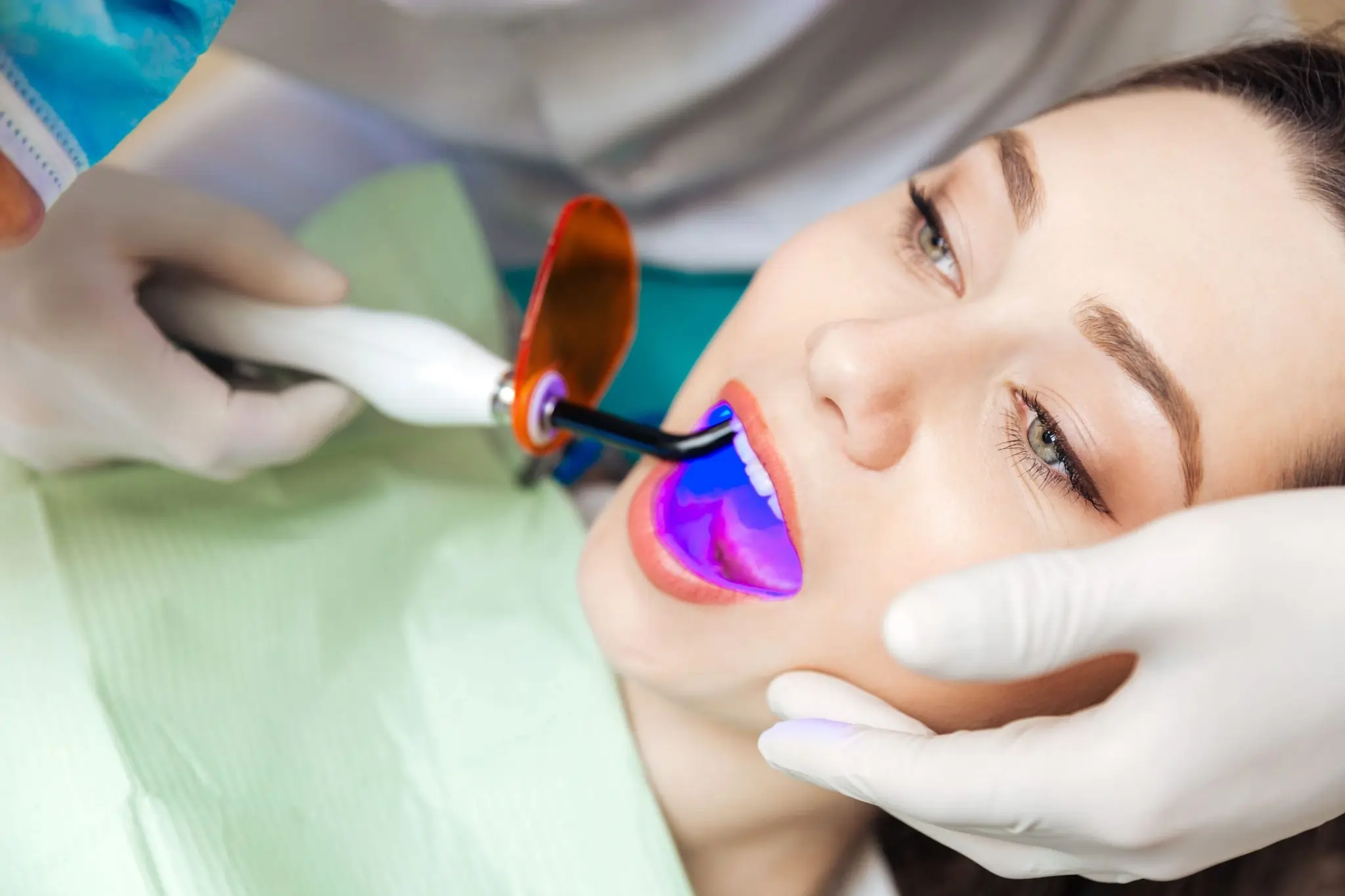 Common Risks of Whitening Without Expert Dental Guidance Banbury