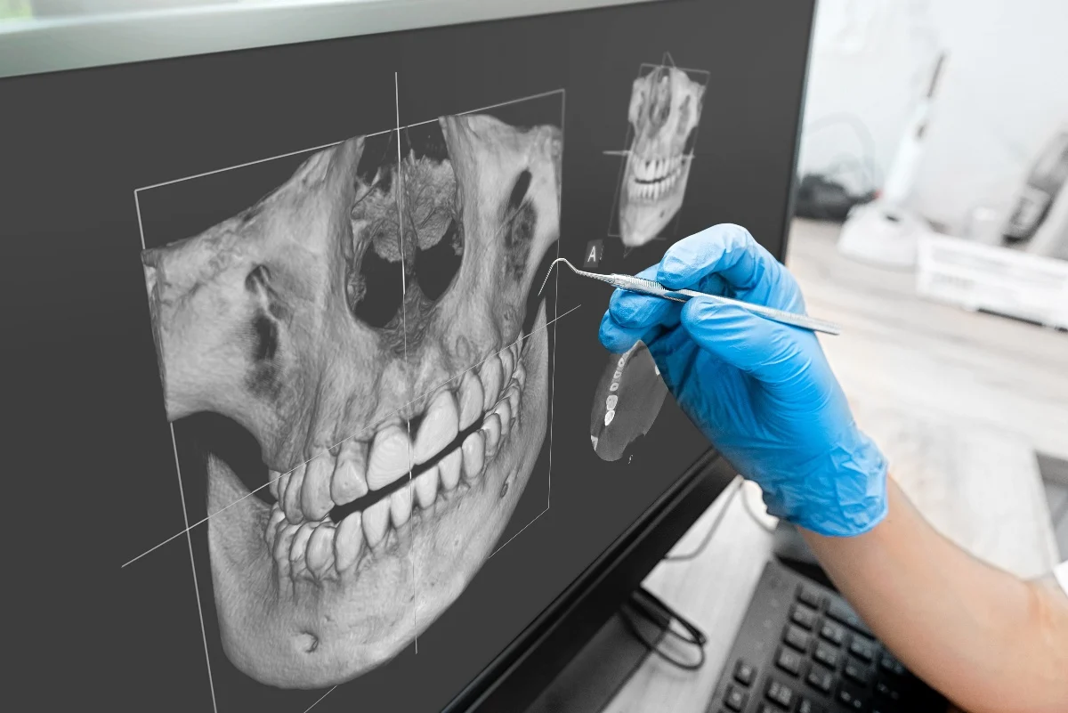 How Is AI Transforming Dental Treatment Planning Banbury?