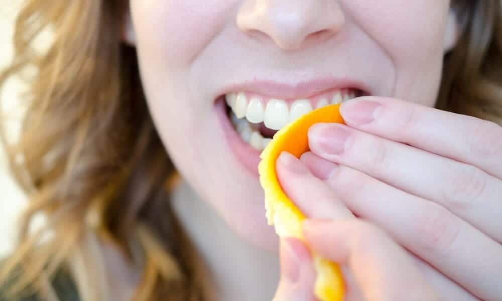 Signs Your Teeth Are Being Damaged by Acid Banbury