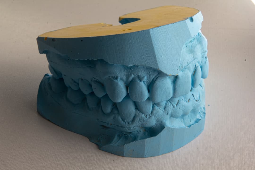 How Do Dental Implants Improve Jawbone Health and Oral Function Banbury?