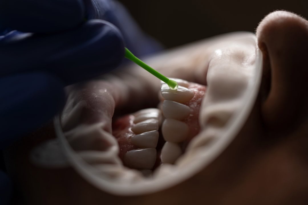 How Saliva Protects Your Teeth and Gums Banbury