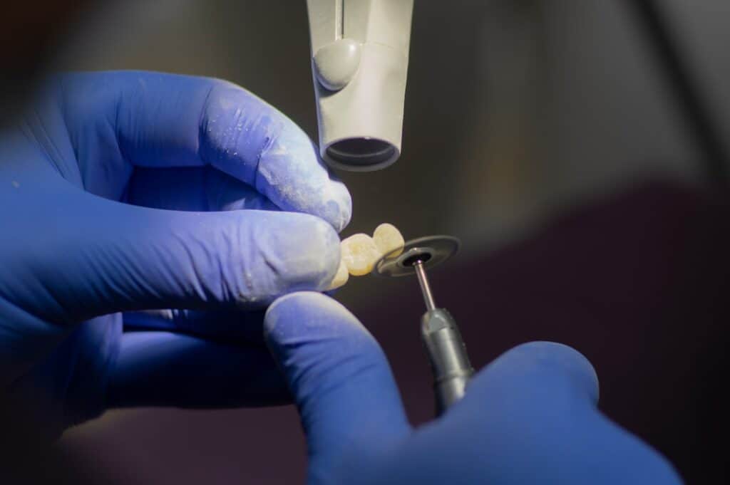 Customised Dental Solutions: Crowns, Aligners, and Implants Banbury