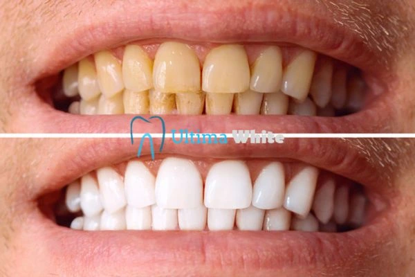 Stained Teeth and Persistent Bad Breath Banbury